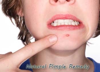 Pimple-solution
